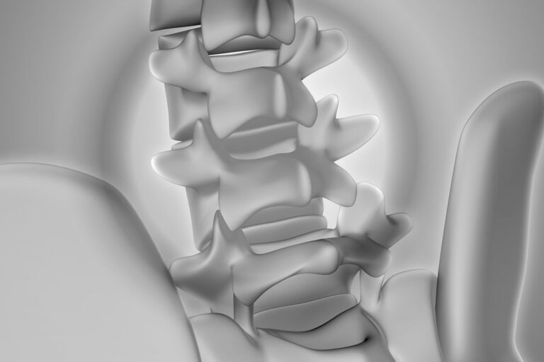 Hernia discal sin cirugía: cómo la terapia MBST regenera el tejido desde dentro